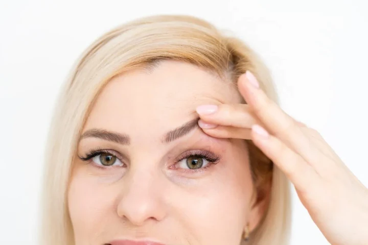 Botox Brow Lift for Hooded Eyes