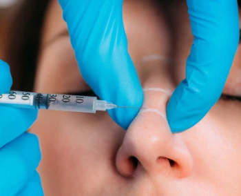 Botox for Nose Slimming