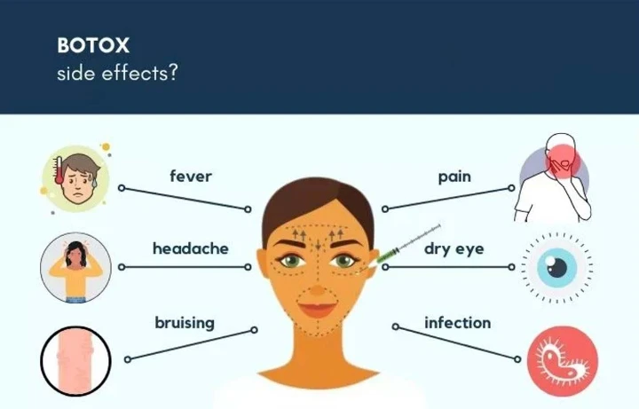 Long Term Effects of Botox