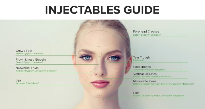 Botox Injection Sites Face Diagram