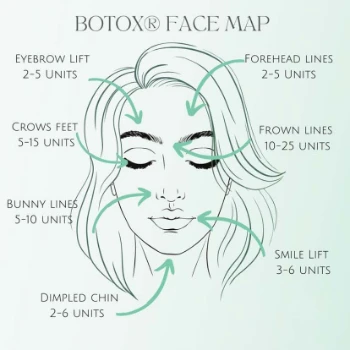 Botox face map