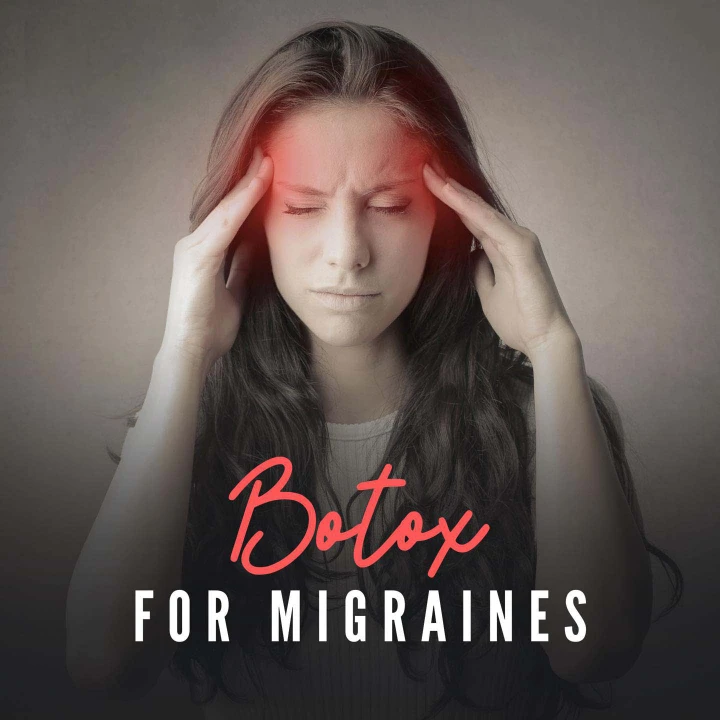 Botox for Migraines